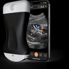 thumb: Clarius C3 HD3 neben einem Smartphone und einem Ultraschallbild der Niere