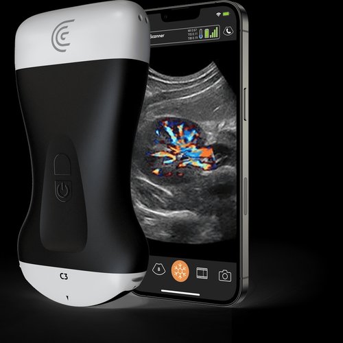 Clarius C3 HD3 neben einem Smartphone und einem Ultraschallbild der Niere