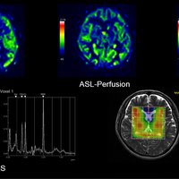 thumb: ECHELON Smart 1,5T