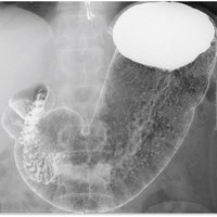 thumb: Aufnahme mit Xantara