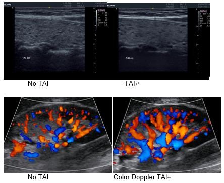 Tissue Adaptive Imaging (TAI)