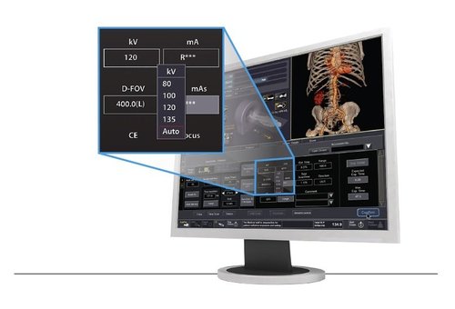 Anwendung der automatischen kV Selektion mit dem Aquilion Lightning SP