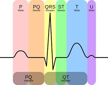 EKG-Welle